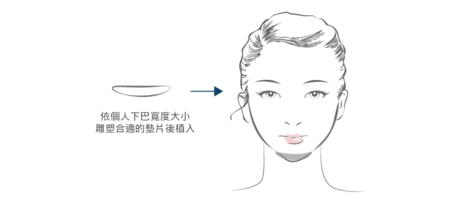 墊下巴-03.jpg