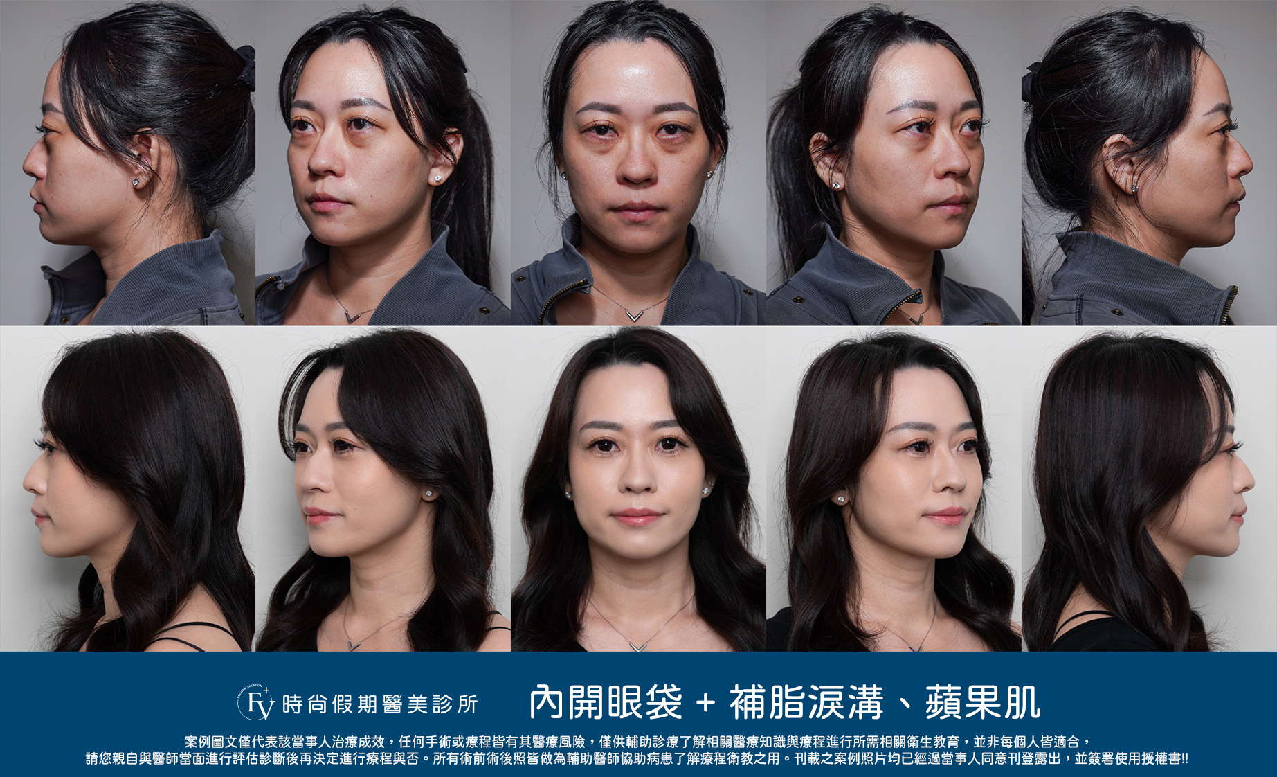 三角度術前術後照+logo 拷貝.jpg